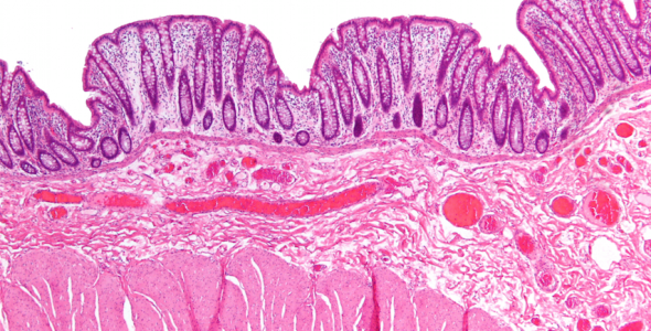 prolasso del retto varese vergiate