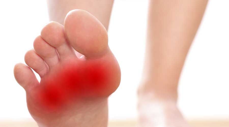 Metatarsalgia Vergiate Varese