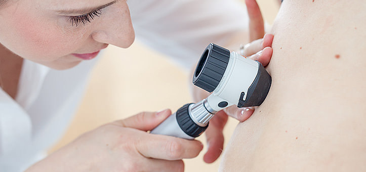 prevenzione del melanoma vergiate varese