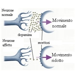 La dopamina nel cervello è decisiva per il coordinamento dei movimenti nell'uomo.