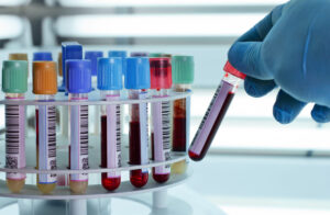 Test Diagnostici