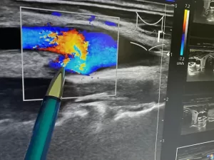 Eco Color Doppler Vergiate Varese